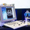 Ростех впервые представил новейшее оборудование для ультразвуковой диагностики и лечения рака