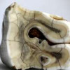 Российские учёные создали искусственную зубную эмаль тверже натуральной